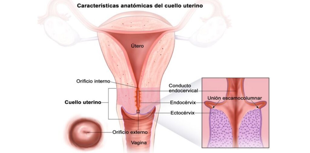 Cáncer de utero